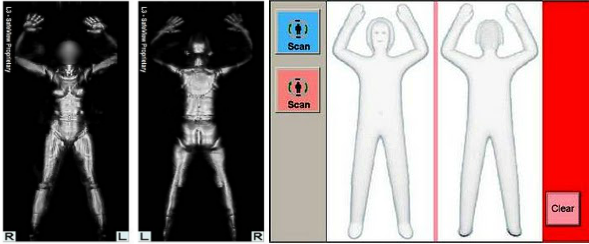 Opting Out Of Airport Body Scanners The Global Gadabout